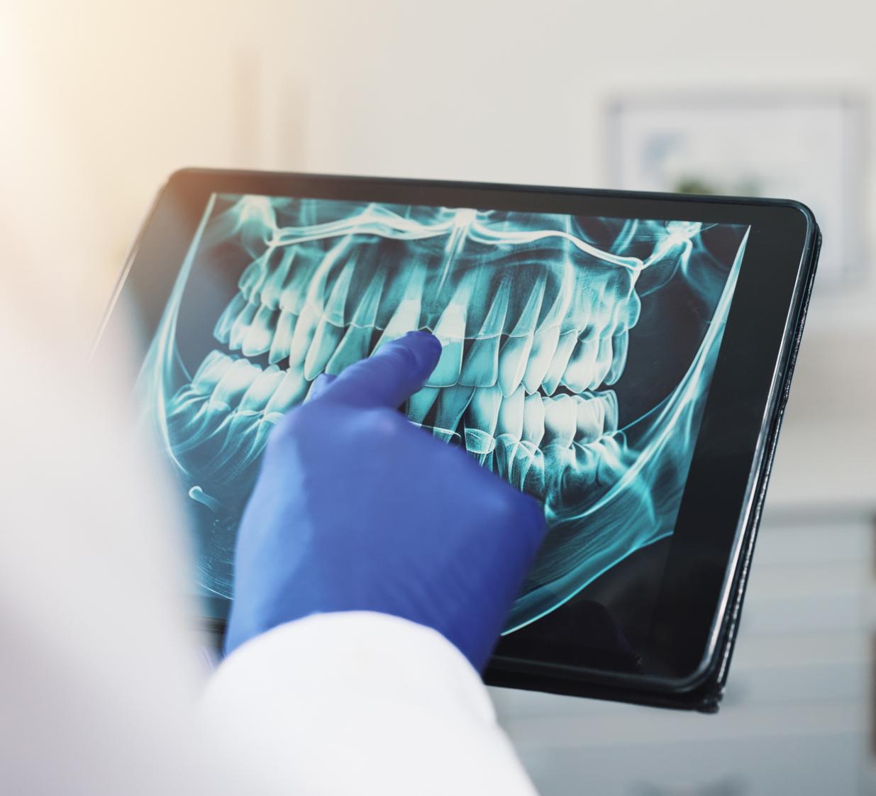 dentist looking at an x-ray of teeth